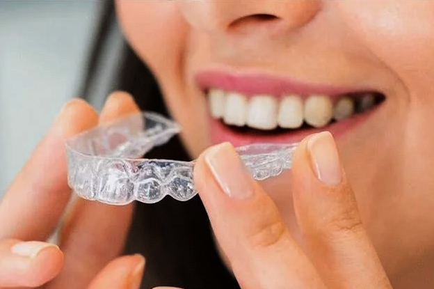 Invisalign Richmond, Money Off Invisalign